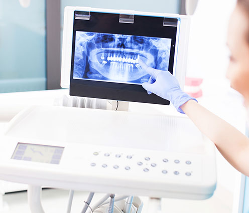 Dental X-Rays | Fort Rouge Dental Group